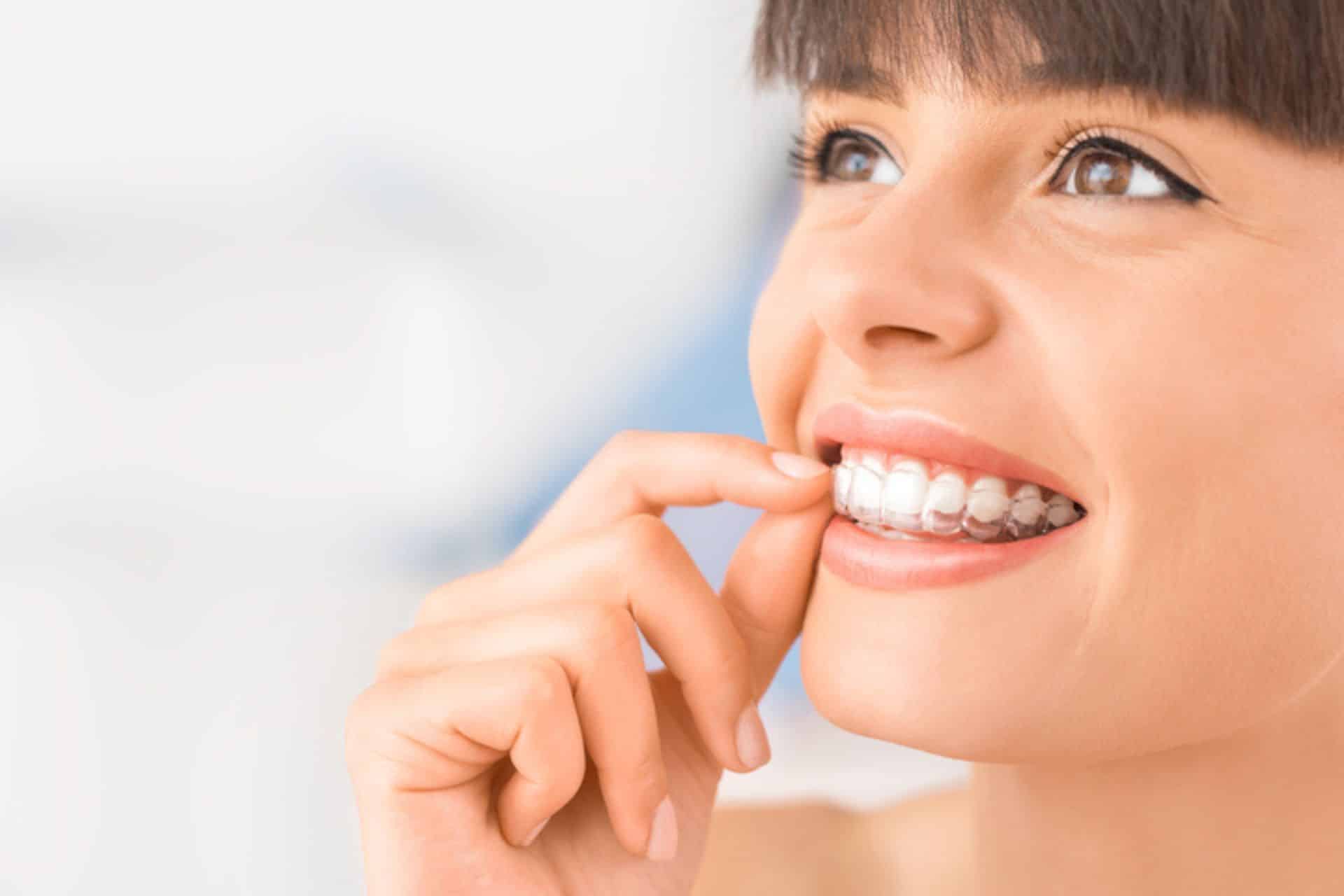 How Do You Travel With Braces and Invisalign? Advanced Orthodontics in Bellevue, WA